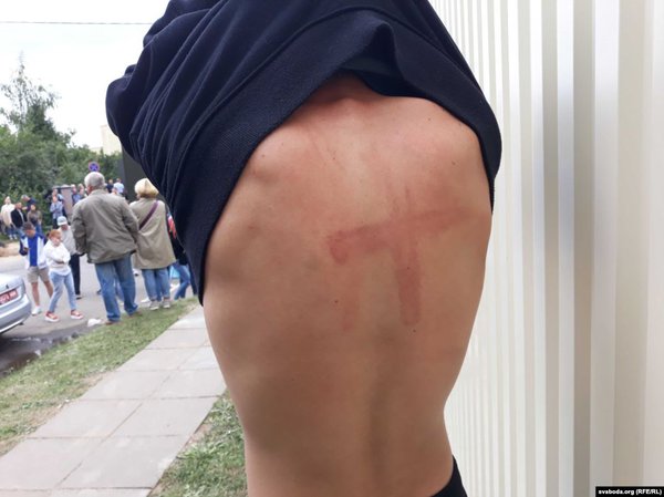 Білорусь: тисячі затриманих і показова жорстокість силовиків (ФОТО 16+)