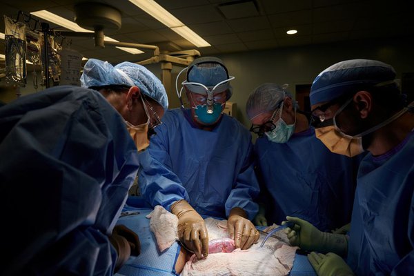 Людині вперше успішно трансплантували нирку генномодифікованої свині