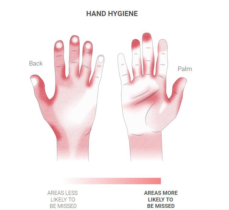 Чим червоніший колір на інфографіці – тим більша ймовірність пропустити цю частину рук при митті