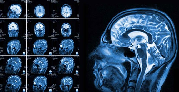 Фото ілюстративне, з відкритих джерел